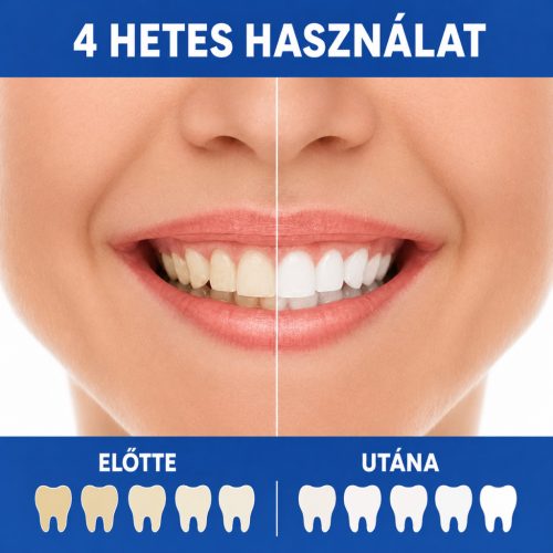 Oclean Flow szónikus elektromos fogkefe – IPX7, fehér
