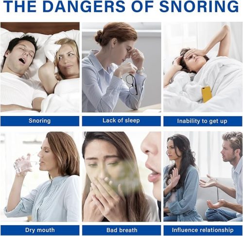 Anogol anti-horkoló sín – állítható, minden szájformához, kényelmes éjszakai használatra
