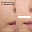 Braun Silk·expert Pro 5 PL5157 – IPL szőrtelenítő készülék