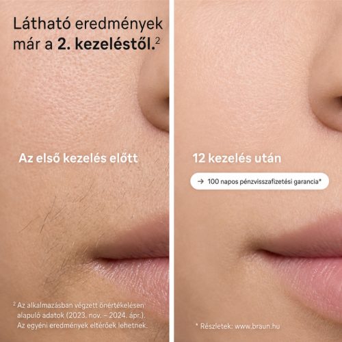 Braun Silk·expert Pro 5 PL5157 – IPL szőrtelenítő készülék