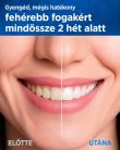 Yteath Y05 szónikus Elektromos Fogkefe
