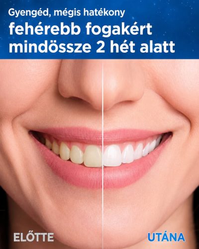 Yteath Y05 szónikus Elektromos Fogkefe