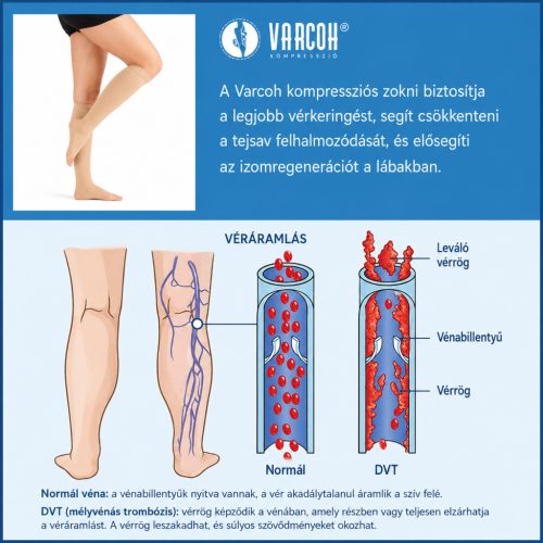 VARCOH – 20–30 mmHg kompressziós térdzokni, nyitott orr-résszel